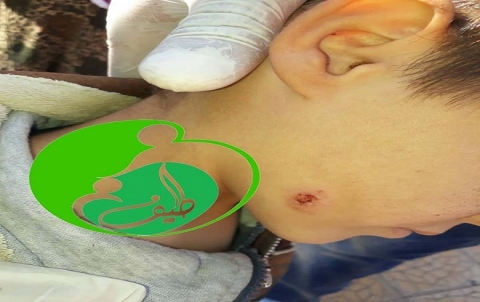 إنتهاء المعركة التي دارت بين منظمة طيف للأعمال الانسانية وذبابة الرمل 