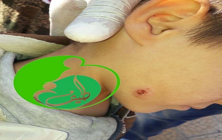 إنتهاء المعركة التي دارت بين منظمة طيف للأعمال الانسانية وذبابة الرمل